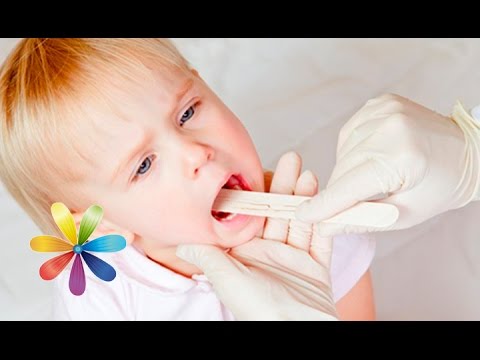 Behandling av betennelse i mandlene hos barn hjemme