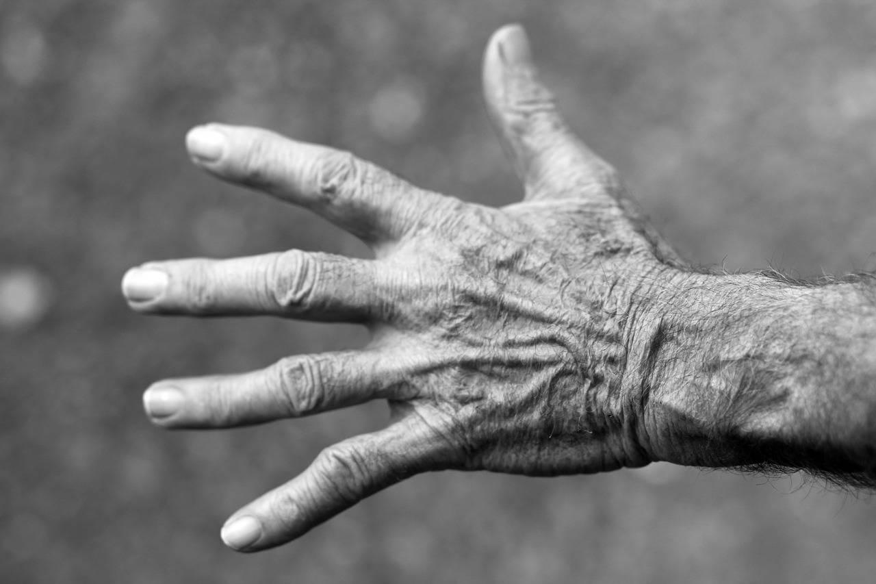 Kuinka hoitaa ihottumaa käsissä